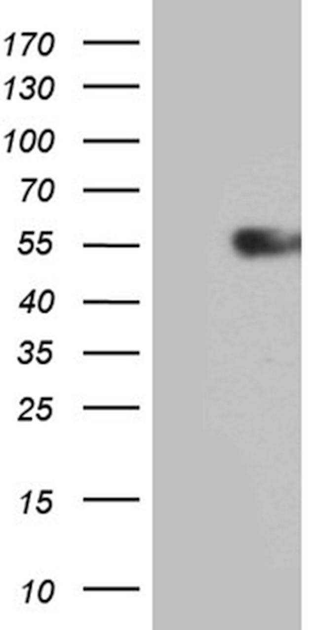 IL15RA Antibody in Western Blot (WB)