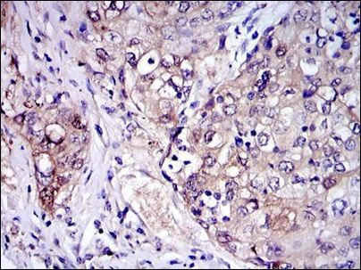 IRAK4 Antibody in Immunohistochemistry (Paraffin) (IHC (P))