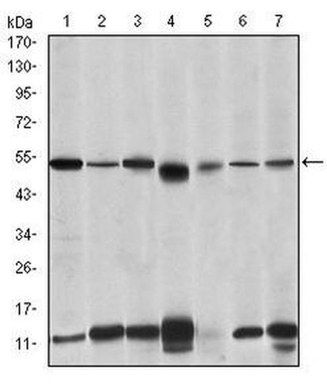 IRAK4 Antibody in Western Blot (WB)