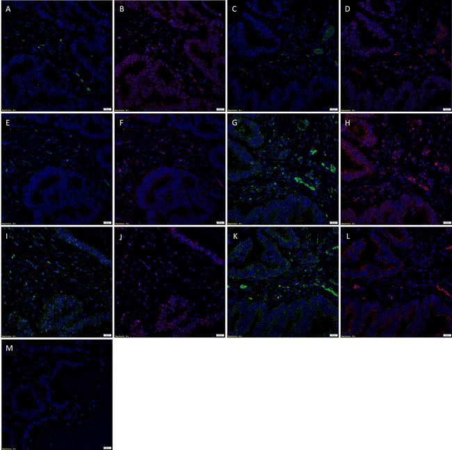 SOX2 Antibody in Immunohistochemistry (IHC)