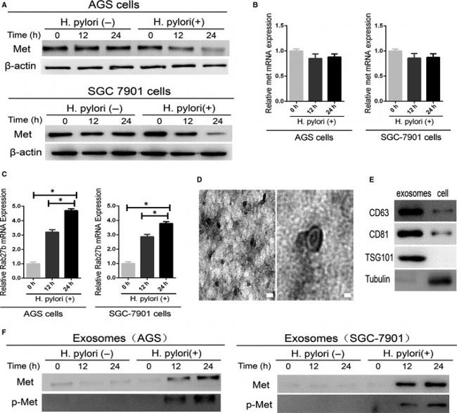 CD81 Antibody in Western Blot (WB)