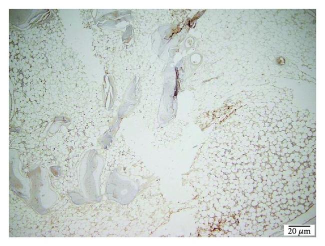 Laminin Antibody in Immunohistochemistry (IHC)