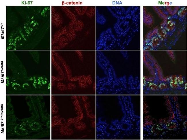 Ki-67 Antibody in Immunocytochemistry (ICC/IF)