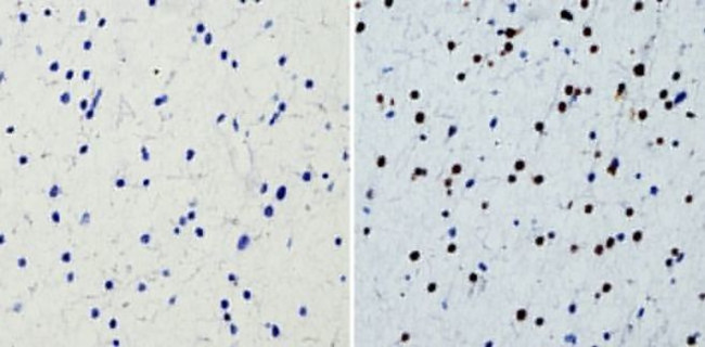 SOX2 Antibody in Immunohistochemistry (Paraffin) (IHC (P))