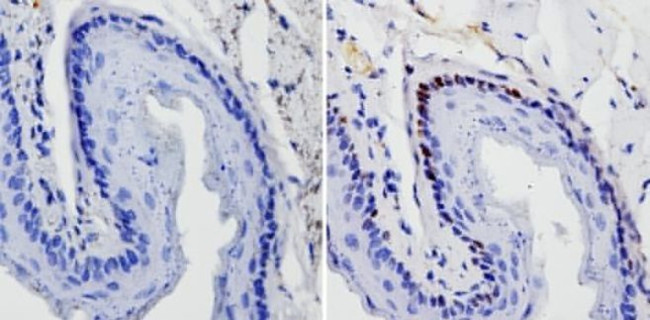 SOX2 Antibody in Immunohistochemistry (Paraffin) (IHC (P))