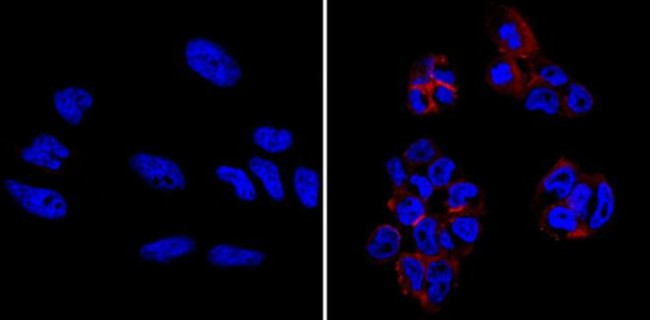 TRA-1-60 Antibody in Immunocytochemistry (ICC/IF)