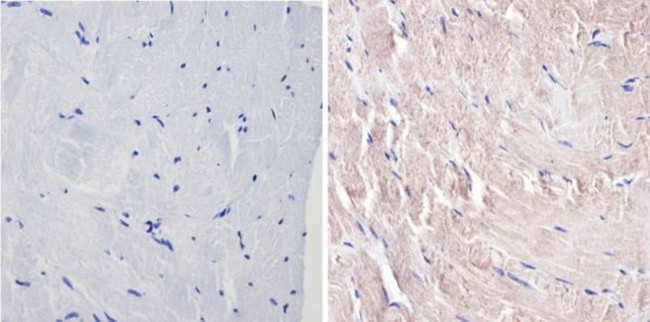 p38 MAPK gamma Antibody in Immunohistochemistry (Paraffin) (IHC (P))