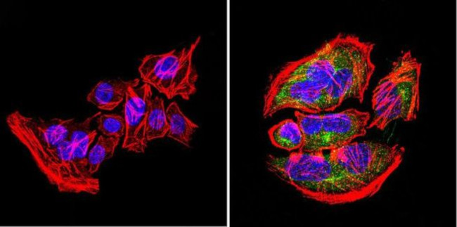 Nestin Antibody in Immunocytochemistry (ICC/IF)