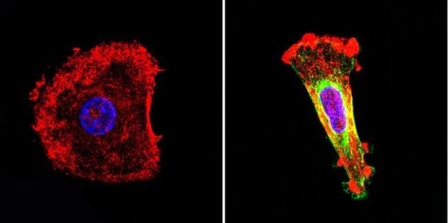 Nestin Antibody in Immunocytochemistry (ICC/IF)