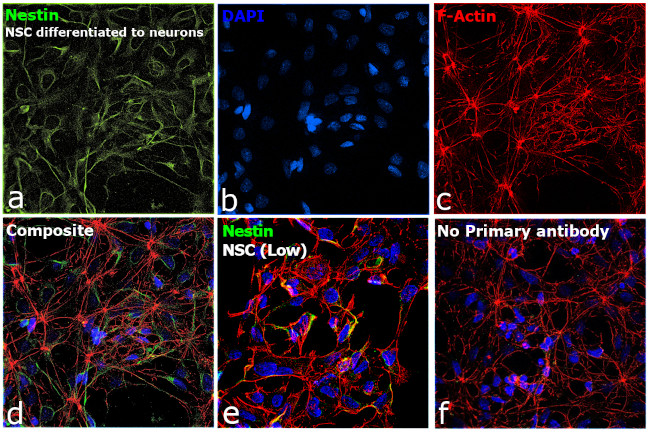 Nestin Antibody in Immunocytochemistry (ICC/IF)