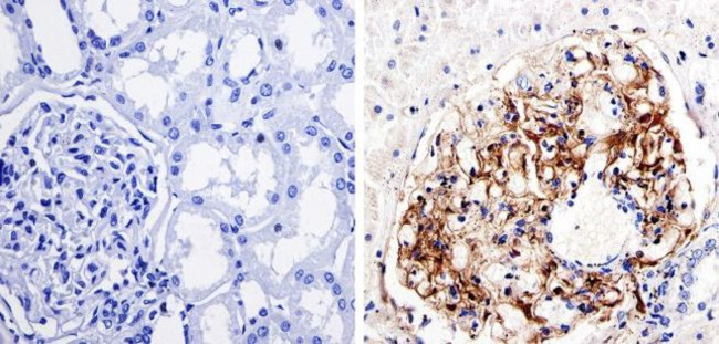 Nestin Antibody in Immunohistochemistry (IHC)