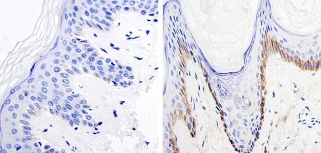 Nestin Antibody in Immunohistochemistry (IHC)