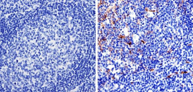 Nestin Antibody in Immunohistochemistry (IHC)