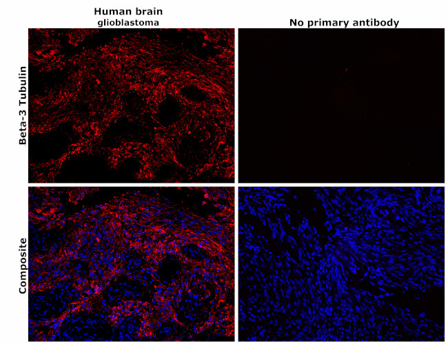 beta-3 Tubulin Antibody in Immunohistochemistry (Paraffin) (IHC (P))