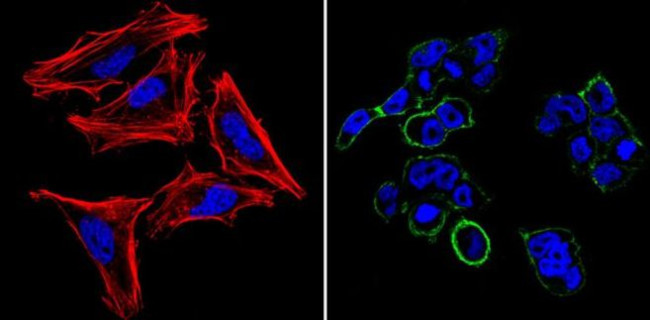 SSEA5 Antibody in Immunocytochemistry (ICC/IF)