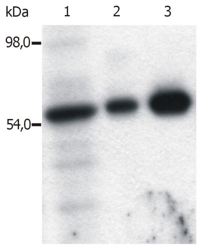 Fyn Antibody in Immunoprecipitation (IP)