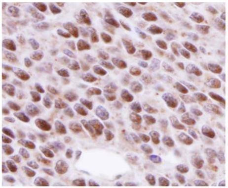 RAD51 Antibody in Immunohistochemistry (Paraffin) (IHC (P))