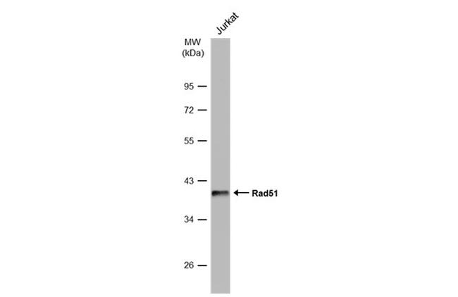 RAD51 Antibody in Western Blot (WB)