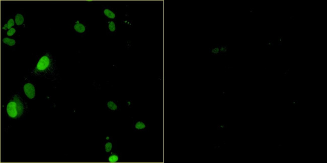 Bovine Papilloma Virus Type 1 E2 Antibody in Immunocytochemistry (ICC/IF)