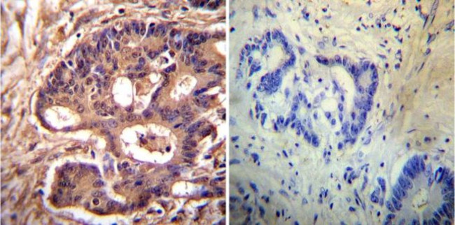 alpha Actinin 4 Antibody in Immunohistochemistry (Paraffin) (IHC (P))