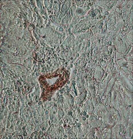 beta Actin Antibody in Immunohistochemistry (Paraffin) (IHC (P))