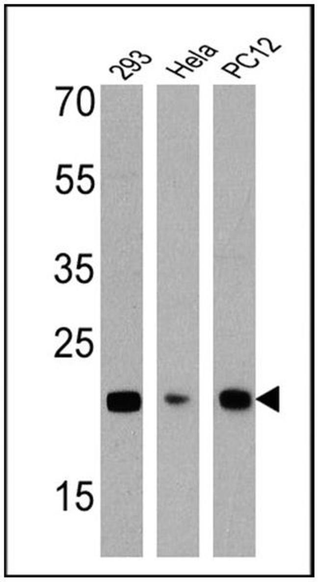 DIABLO Antibody in Western Blot (WB)