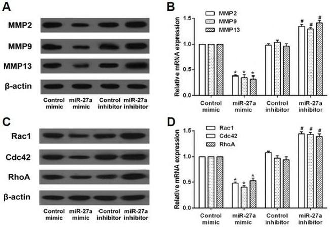 RAC1 Antibody in Western Blot (WB)