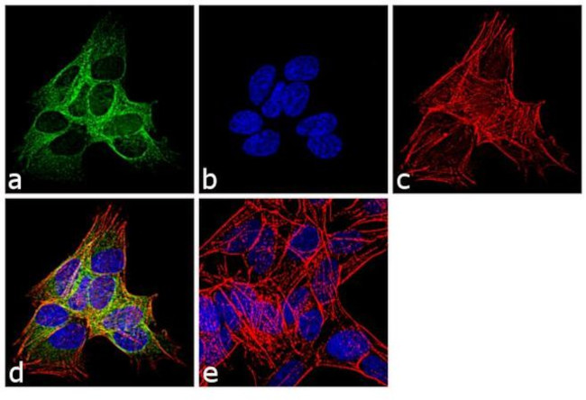 beta-3 Tubulin Antibody in Immunocytochemistry (ICC/IF)