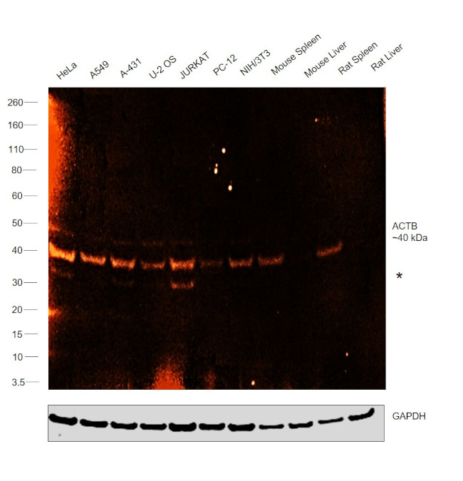 beta Actin Antibody