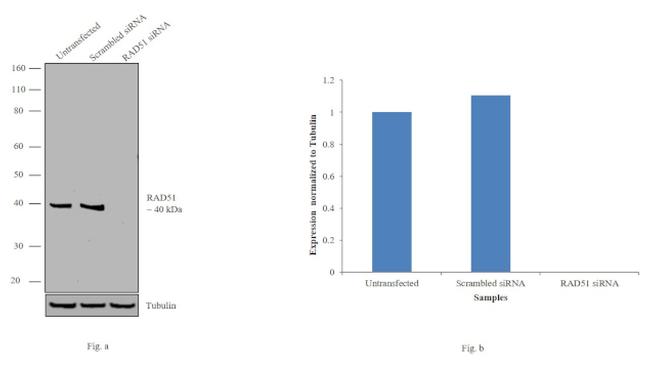 RAD51 Antibody in Western Blot (WB)