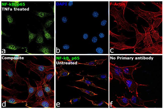 NFkB p65 Antibody