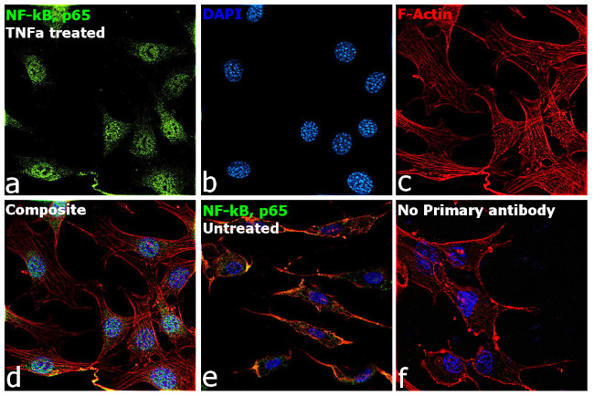 NFkB p65 Antibody in Immunocytochemistry (ICC/IF)