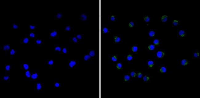 CD18 Antibody in Immunocytochemistry (ICC/IF)