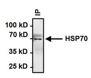 HSP70 Antibody in Immunoprecipitation (IP)