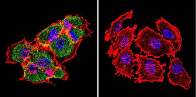 HSP70 Antibody in Immunocytochemistry (ICC/IF)