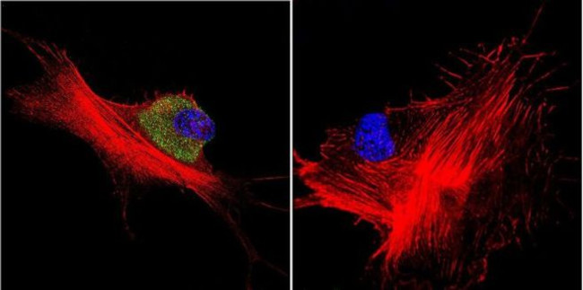 HSP70 Antibody in Immunocytochemistry (ICC/IF)