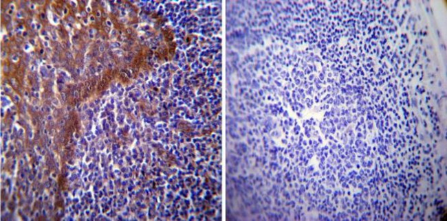 HSP70 Antibody in Immunohistochemistry (Paraffin) (IHC (P))