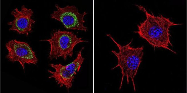 HSP60 Antibody in Immunocytochemistry (ICC/IF)