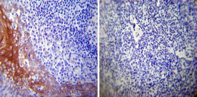 HSP27 Antibody in Immunohistochemistry (Paraffin) (IHC (P))