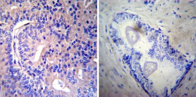 RAB9 Antibody in Immunohistochemistry (Paraffin) (IHC (P))