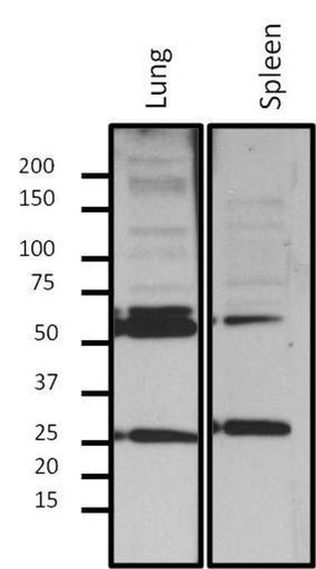 Lamin A/C Antibody in Western Blot (WB)