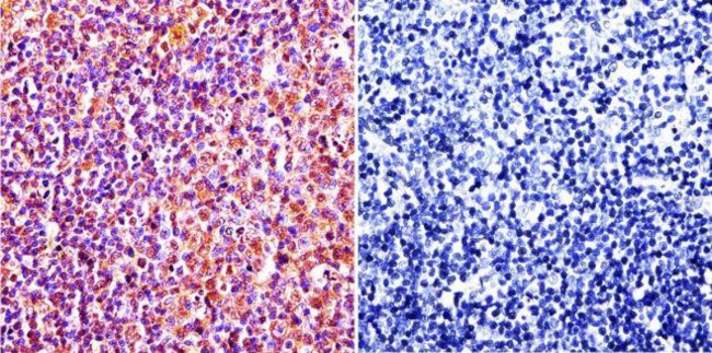 Caveolin 1 Antibody in Immunohistochemistry (Paraffin) (IHC (P))