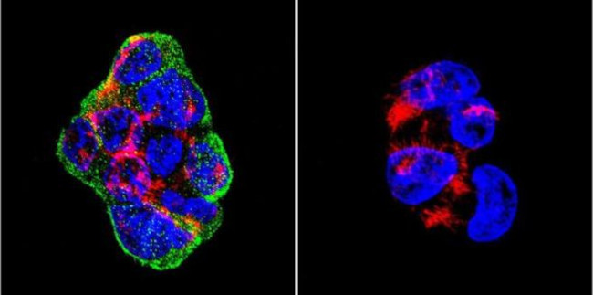 Vimentin Antibody in Immunocytochemistry (ICC/IF)