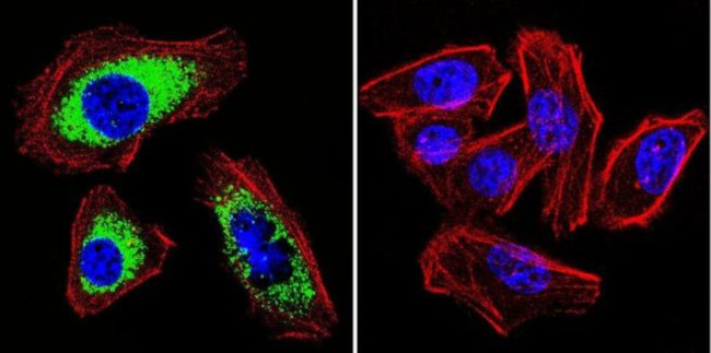 SERCA2 ATPase Antibody in Immunocytochemistry (ICC/IF)