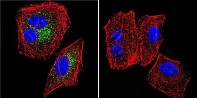 SERCA2 ATPase Antibody in Immunocytochemistry (ICC/IF)