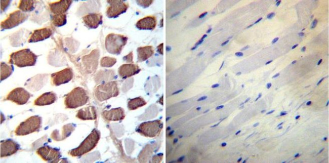 SERCA2 ATPase Antibody in Immunohistochemistry (Paraffin) (IHC (P))