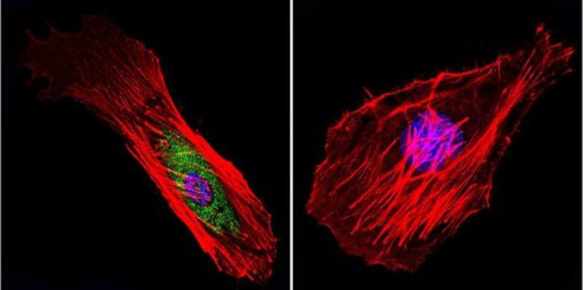 Mu-Calpain Antibody in Immunocytochemistry (ICC/IF)