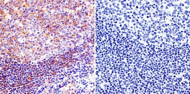 Mu-Calpain Antibody in Immunohistochemistry (Paraffin) (IHC (P))