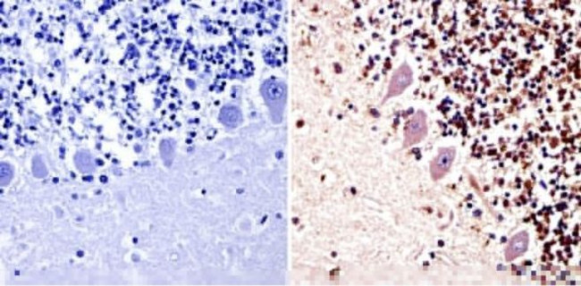 PARP1 Antibody in Immunohistochemistry (Paraffin) (IHC (P))