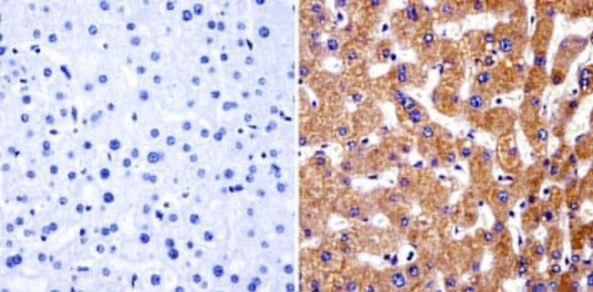 PARP1 Antibody in Immunohistochemistry (Paraffin) (IHC (P))